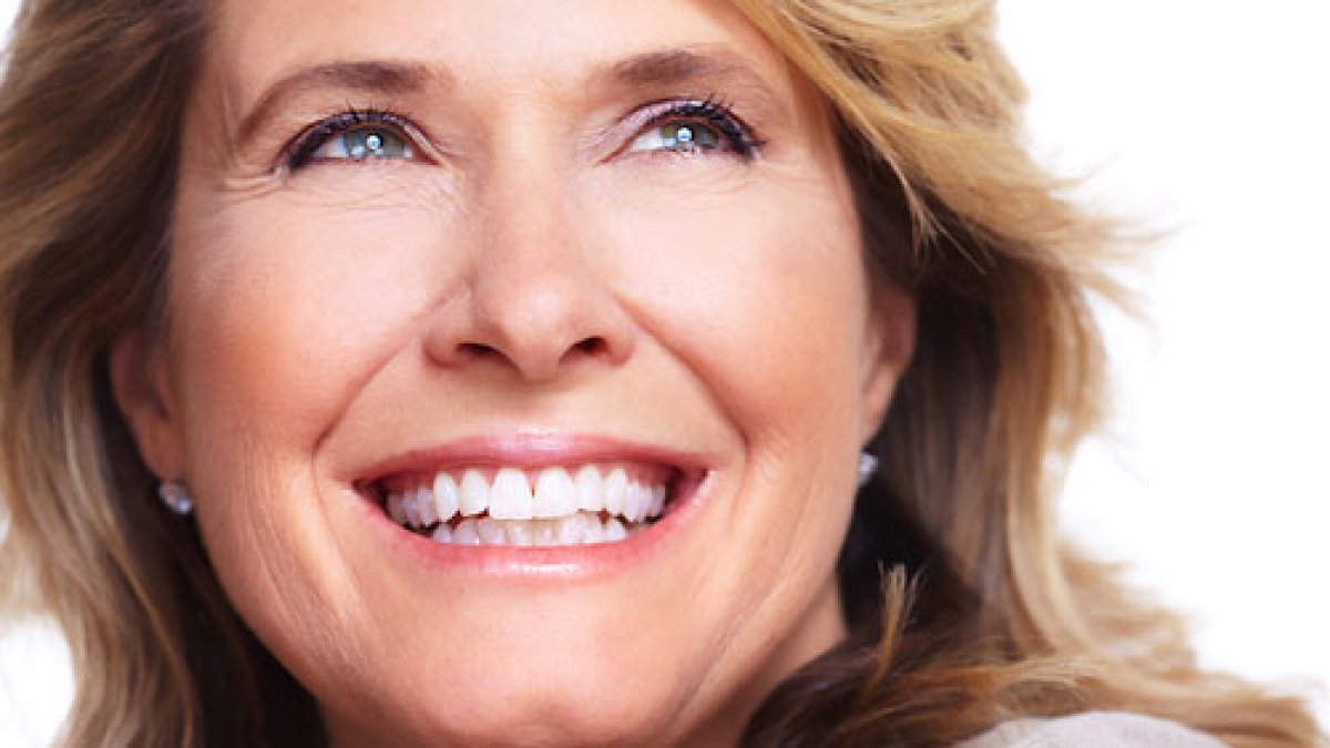 veneers_1 __Sunrise Dental | Chapel Hill | Durham | Raleigh | Cary, NC